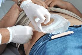 Manejo e Cuidados com Colostomia + Traqueostomia